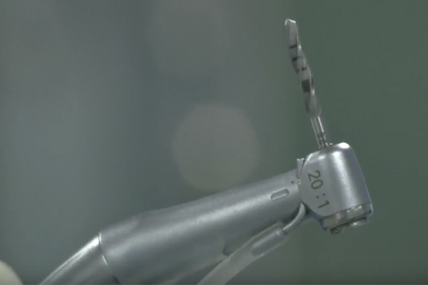 Робот-стоматолог провел операцию без помощи человека